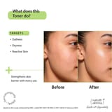 Hyaluronic Acid Toner Essence with Natural Biome-Boost™ Solution - 100 ml thumbnail 3